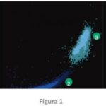 Células nucleadas de la serie roja y reticulocitos: utilidad en el laboratorio clínico