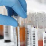Interferencias por Fármacos en Análisis Clínicos: Hemoglobina Glicosilada (HbA c)