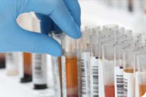 Interferencias por Fármacos en Análisis Clínicos: Hemoglobina Glicosilada (HbA c)