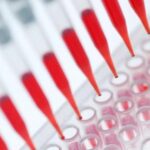La técnica MABA (Multiple Antigen Blot Assay): una aproximación de bajo costo al diagnóstico simultáneo de múltiples enfermedades infecciosas