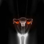 Niveles de hormona antimulleriana y factor neurotrófico derivado del cerebro como predictores de función ovárica