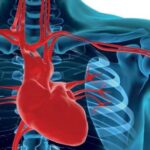 Perfil lipídico en pacientes con diagnóstico reciente de cardiopatía isquémica: estudio transversal en 2012 y 2013, Hospital Luis Vernaza, Ecuador