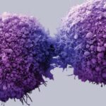 Rendimiento diagnóstico del marcador tumoral CA 19-9 en la diferenciación entre patología bilio-pancreática benigna y maligna