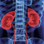 Estudio de exactitud diagnóstica que compara fosfatasa alcalina total con paratohormona intacta 1-84 para el diagnóstico de osteodistrofia renal de alto recambio en la insuficiencia renal crónica en hemodiálisis