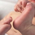 Nesidioblastosis: hipoglucemia hiperinsulínica persistente en un recién nacido