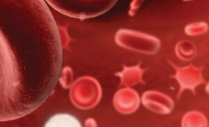 Frecuencia del síndrome de plaquetas pegajosas en pacientes con pérdidas fetales recurrentes