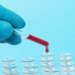 Documento de consenso para la determinación e informe del perfil lipídico en laboratorios clínicos españoles ¿Qué parámetros debe incluir un perfil lipídico básico?