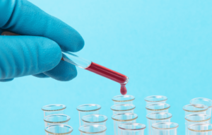 Documento de consenso para la determinación e informe del perfil lipídico en laboratorios clínicos españoles ¿Qué parámetros debe incluir un perfil lipídico básico?