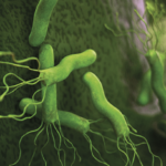 Helicobacter pylori: cuando el diagnóstico oportuno puede hacer una enorme diferencia
