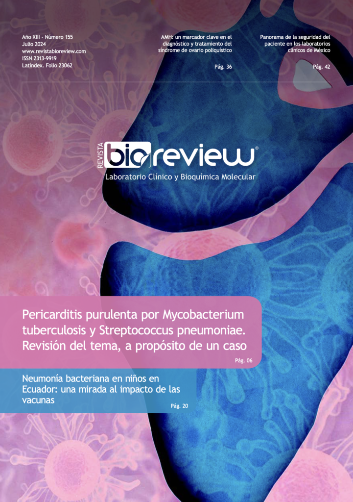 Pericarditis purulenta por Mycobacterium tuberculosis y Streptococcus pneumoniae. Revisión del tema, a propósito de un caso