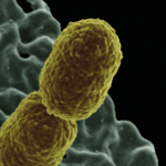 Resistencia antimicrobiana de Enterobacterias causante de infección del tracto urinario en pacientes ambulatorios
