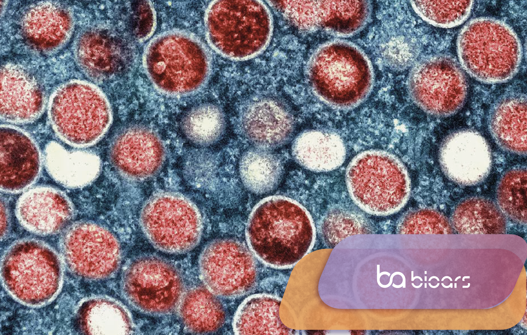 Viruela símica: la evolución viral y su impacto en el diagnóstico molecular
