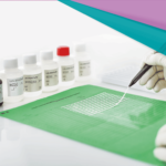 Inmunoensayos lineales (LIA): simplicidad y rapidez en el diagnóstico de la diabetes autoinmune