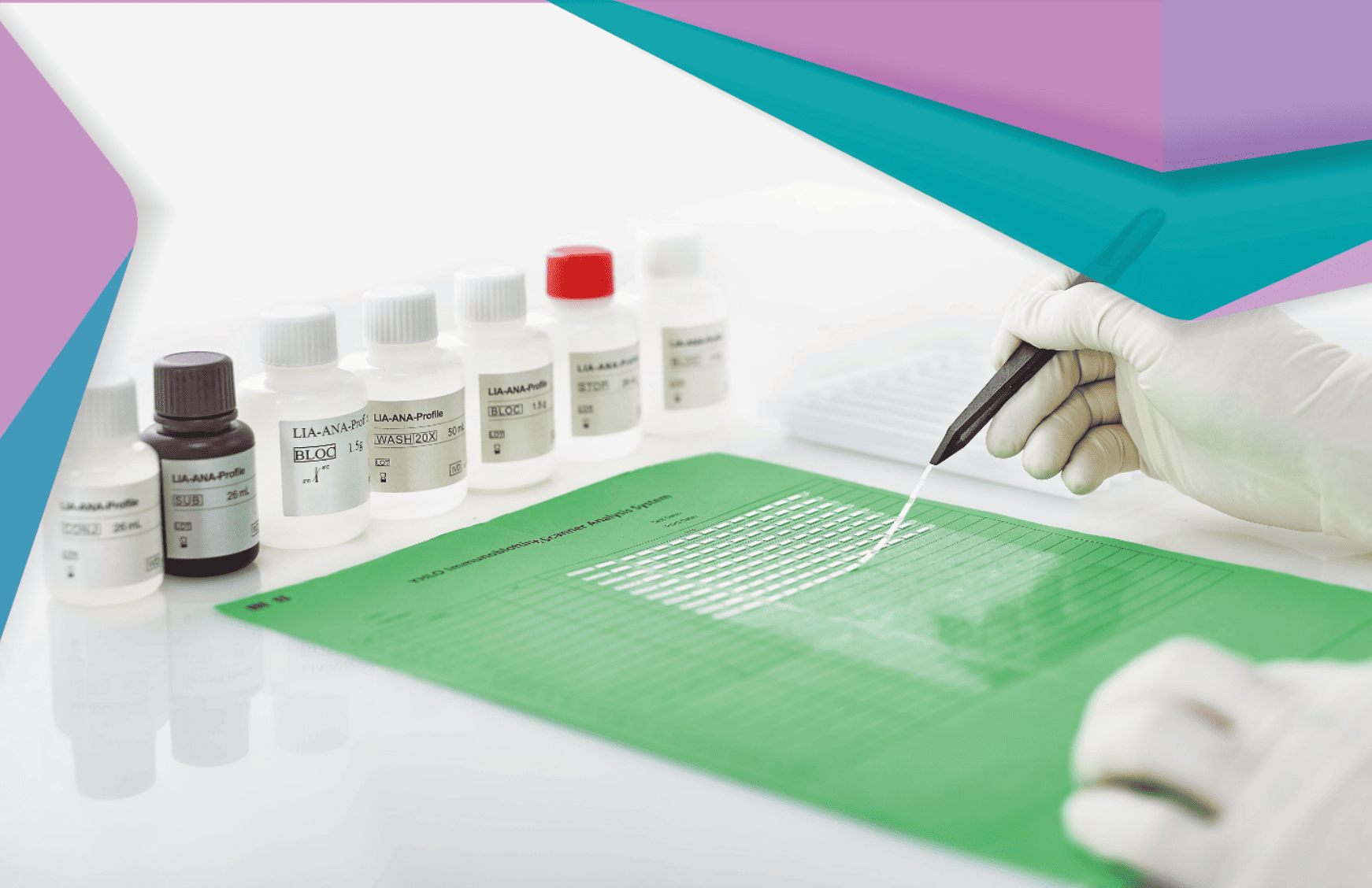 Inmunoensayos lineales (LIA): simplicidad y rapidez en el diagnóstico de la diabetes autoinmune