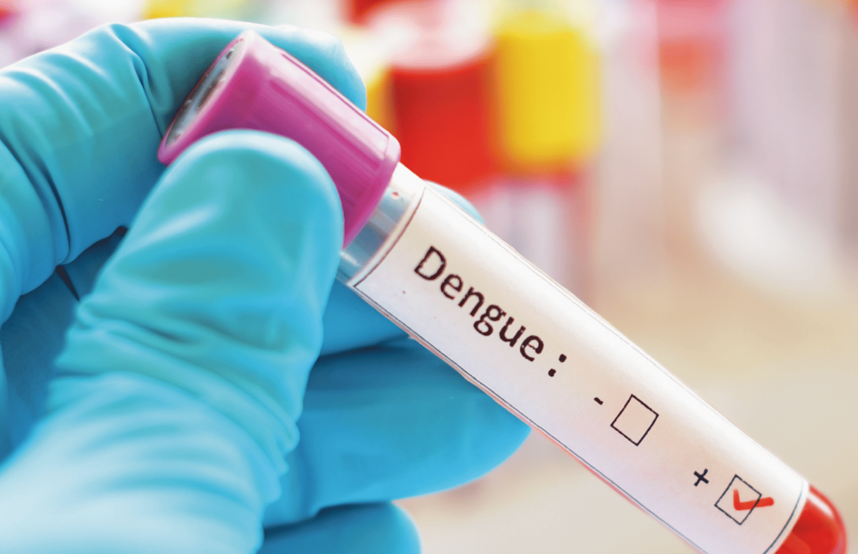 Elección de la metodología adecuada para el diagnóstico de dengue