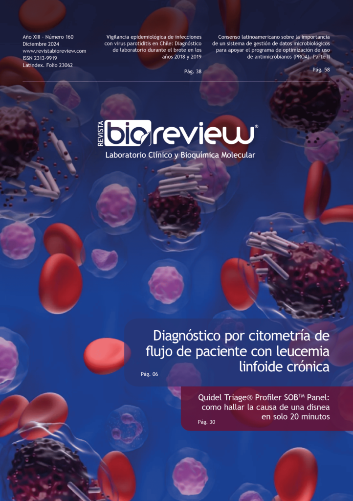 Diagnóstico por citometría de flujo de paciente con leucemia linfoide crónica