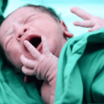 Sepsis bacteriana precoz en recién nacidos del Centro Hospitalario Pereira Rossell, años 2014-2020. Incidencia, factores de riesgo y resultados neonatales