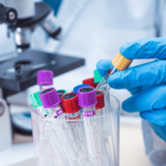 Surgimiento y evolución de los sistemas de normalización para laboratorios clínicos