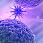 Impacto de la mutación T315I en el pronóstico de la leucemia mieloide crónica