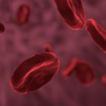 Hemoglobinuria paroxística nocturna: Una causa infrecuente y tratable de lesión renal aguda. Caso clínico