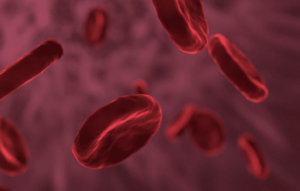 Hemoglobinuria paroxística nocturna: Una causa infrecuente y tratable de lesión renal aguda. Caso clínico