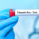 Interferencia por macrocomplejos B12: hacia una detección eficaz e interpretación correcta de la hipo e hipervitaminemia