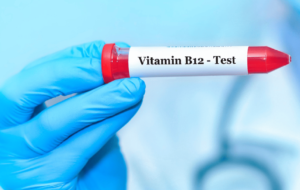 Interferencia por macrocomplejos B12: hacia una detección eficaz e interpretación correcta de la hipo e hipervitaminemia