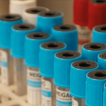 Atención Bioquímica en Medicina Regenerativa: El Rol Clave del PRP y el Profesional Bioquímico
