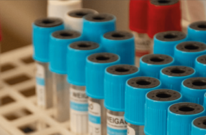 Atención Bioquímica en Medicina Regenerativa: El Rol Clave del PRP y el Profesional Bioquímico