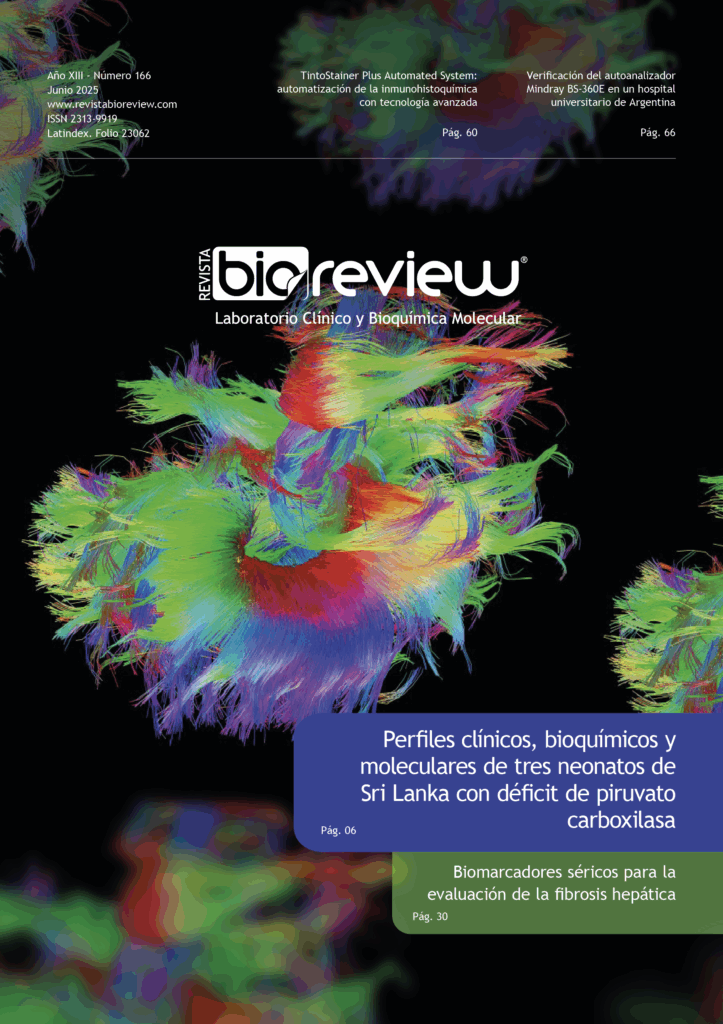 Perfiles clínicos, bioquímicos y moleculares de tres neonatos de Sri Lanka con déficit de piruvato carboxilasa