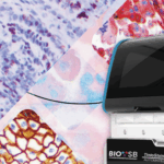 automatización de la inmunohistoquímica con tecnología avanzada