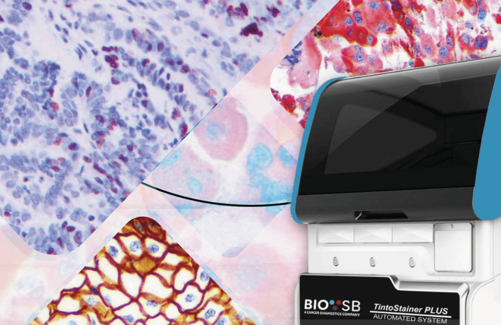 automatización de la inmunohistoquímica con tecnología avanzada