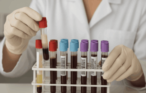 Manejo de muestras lipémicas en el Laboratorio Clínico
