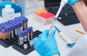 Errores preanalíticos en laboratorios clínicos: revisión integrativa