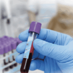 Diagnóstico veterinario para el laboratorio clínico