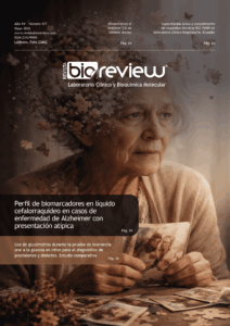 Perfil de biomarcadores en líquido cefalorraquídeo en casos de enfermedad de Alzheimer con presentación atípica